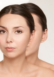 Comparativo de mujer con sus orejas antes y después de una Otoplastia DuqueMD Dr. Jorge Duque Silva