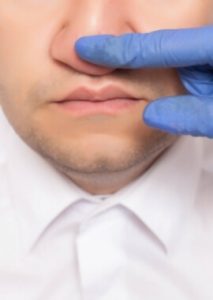 Tabique nasal desviado y obstruido. Septorrinoplastia. DuqueMD Dr. Jorge Duque Silva