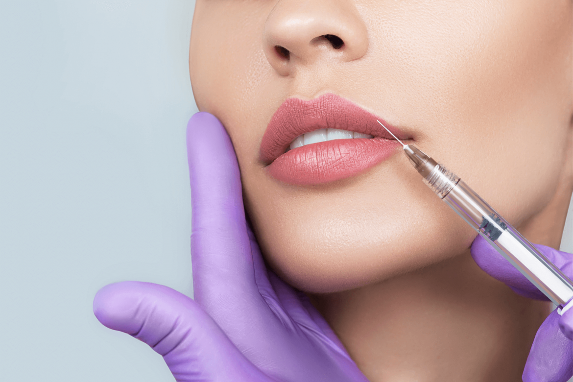 Mujer aplicándose ácido hialorónico en los labios para definición, perfilamiento y aumento. DuqueMD Dr. Jorge Duque Silva